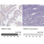 FKBP6 Antibody