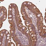 CN079 Polyclonal Antibody