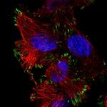 ASAH2 Polyclonal Antibody