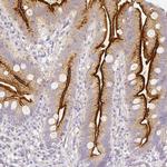 ASAH2 Antibody in Immunohistochemistry (Paraffin) (IHC (P))