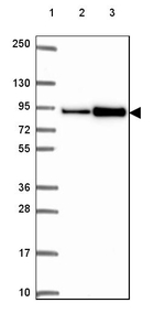 ASAH2 Antibody in Western Blot (WB)