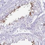 C4orf33 Antibody in Immunohistochemistry (Paraffin) (IHC (P))