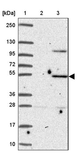 ZNF736 Antibody in Western Blot (WB)