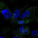 PINLYP Polyclonal Antibody