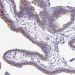 PINLYP Antibody in Immunohistochemistry (IHC)