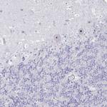 DLK2 Polyclonal Antibody