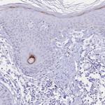PSORS1C2 Polyclonal Antibody