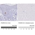 PSORS1C2 Antibody in Immunohistochemistry (IHC)