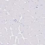PSORS1C2 Antibody in Immunohistochemistry (IHC)