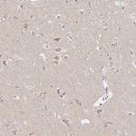 OR51D1 Polyclonal Antibody