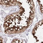 HPS1 Polyclonal Antibody