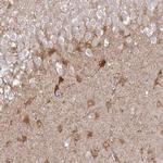 SHISA4 Polyclonal Antibody