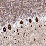 TP53I11 Antibody in Immunohistochemistry (Paraffin) (IHC (P))