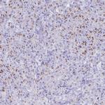 SDR42E2 Polyclonal Antibody