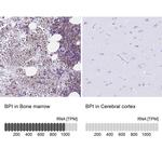 BPI Polyclonal Antibody