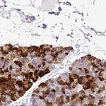 eIF5A Polyclonal Antibody