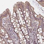 ARHGEF39 Antibody in Immunohistochemistry (Paraffin) (IHC (P))