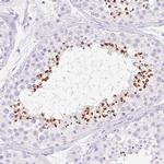SPACA4 Antibody in Immunohistochemistry (IHC)