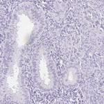 SPACA4 Antibody in Immunohistochemistry (IHC)