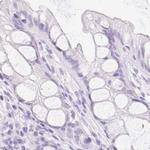 SPACA4 Antibody in Immunohistochemistry (IHC)