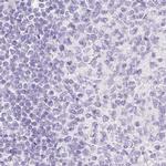 SPACA4 Antibody in Immunohistochemistry (IHC)