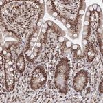 GTF3C6 Antibody in Immunohistochemistry (Paraffin) (IHC (P))