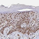 GTF3C6 Antibody in Immunohistochemistry (Paraffin) (IHC (P))
