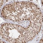 GTF3C6 Antibody in Immunohistochemistry (Paraffin) (IHC (P))