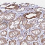 DTNB Antibody in Immunohistochemistry (Paraffin) (IHC (P))
