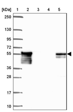 DTNB Antibody in Western Blot (WB)