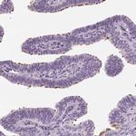 DNAH12 Antibody in Immunohistochemistry (IHC)