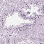 DNAH12 Antibody in Immunohistochemistry (IHC)