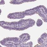 DNAH12 Antibody in Immunohistochemistry (IHC)