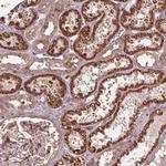 CEP95 Polyclonal Antibody