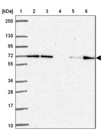 FARSB Antibody in Western Blot (WB)
