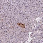 VWA5B2 Antibody in Immunohistochemistry (Paraffin) (IHC (P))