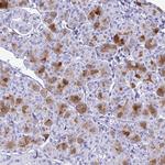 Cystatin D Antibody in Immunohistochemistry (Paraffin) (IHC (P))