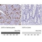 Cystatin D Antibody in Immunohistochemistry (IHC)