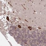 SEC62 Antibody in Immunohistochemistry (Paraffin) (IHC (P))