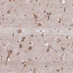SEC62 Antibody in Immunohistochemistry (Paraffin) (IHC (P))