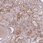SEC62 Antibody in Immunohistochemistry (Paraffin) (IHC (P))