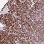 SEC62 Antibody in Immunohistochemistry (Paraffin) (IHC (P))