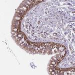 CCDC122 Polyclonal Antibody