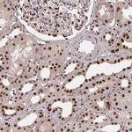 LAS1L Polyclonal Antibody