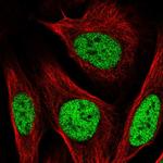 PBX2 Antibody in Immunocytochemistry (ICC/IF)