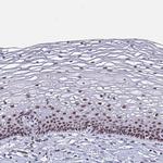 PBX2 Antibody in Immunohistochemistry (Paraffin) (IHC (P))