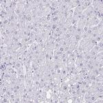 PBX2 Antibody in Immunohistochemistry (Paraffin) (IHC (P))