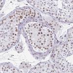 PBX2 Antibody in Immunohistochemistry (Paraffin) (IHC (P))