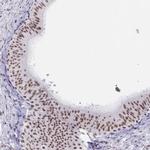 PBX2 Antibody in Immunohistochemistry (IHC)