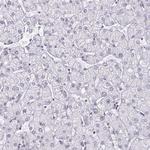 PBX2 Antibody in Immunohistochemistry (IHC)